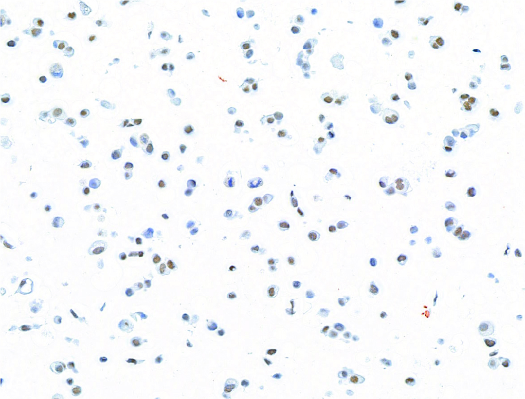 13-2014-immunocytochemistry-data