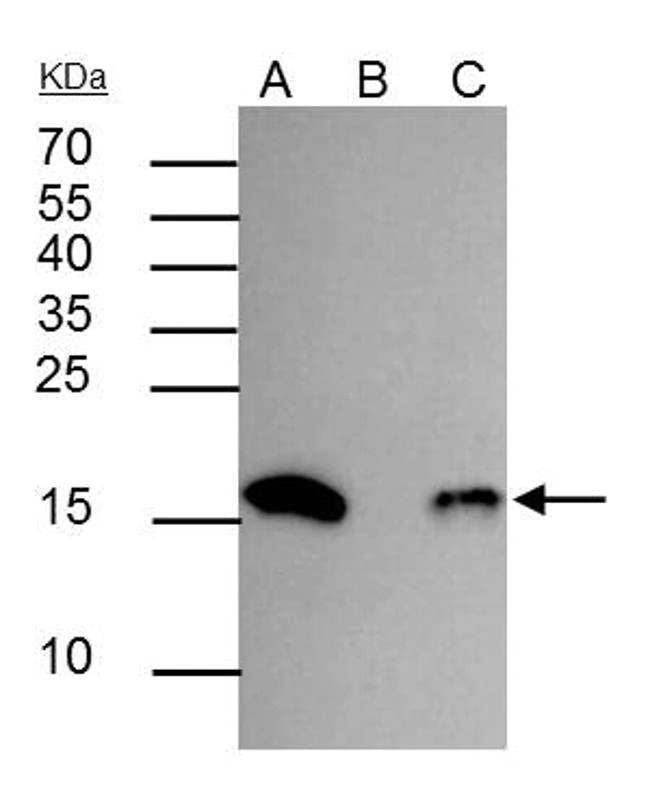 Acetyl-Histone-H3-Lys18-IP