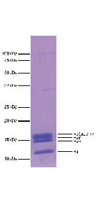 16-1362-protein-gel-data