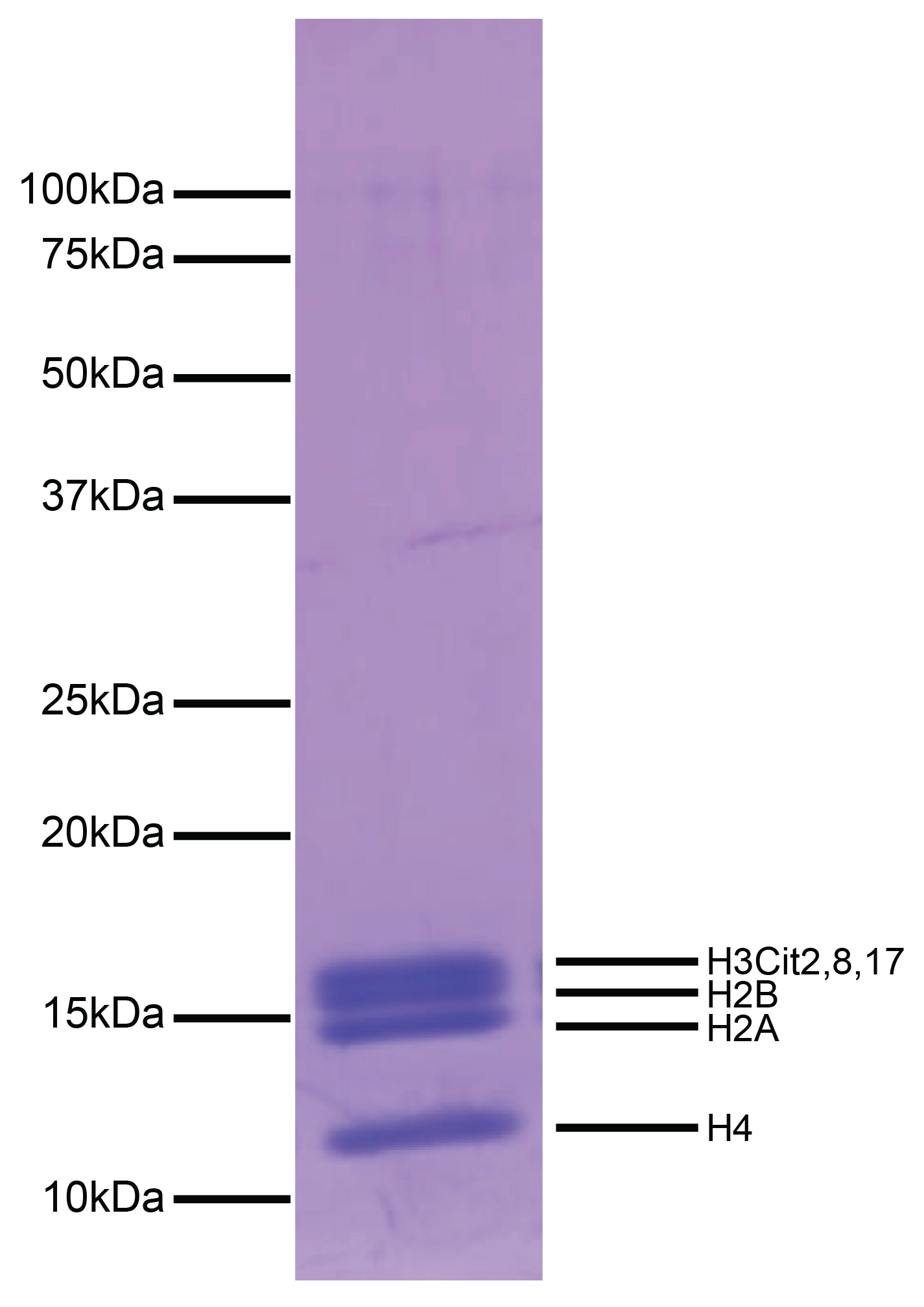 16-1362-protein-gel-data