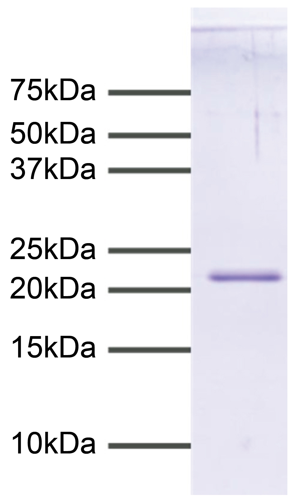 15-0049-protein-gel-data
