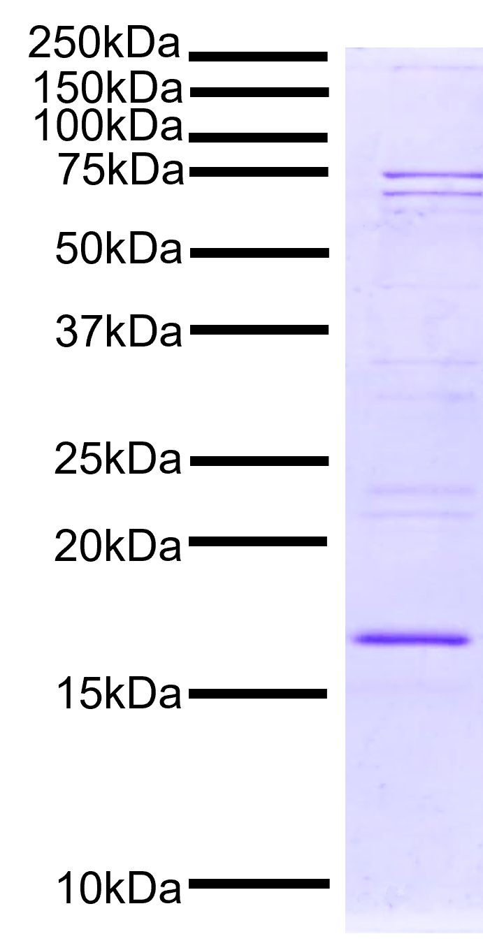 15-0075-protein-gel-data