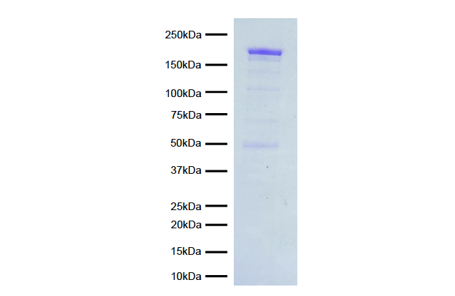 15-1014-protein-gel-data