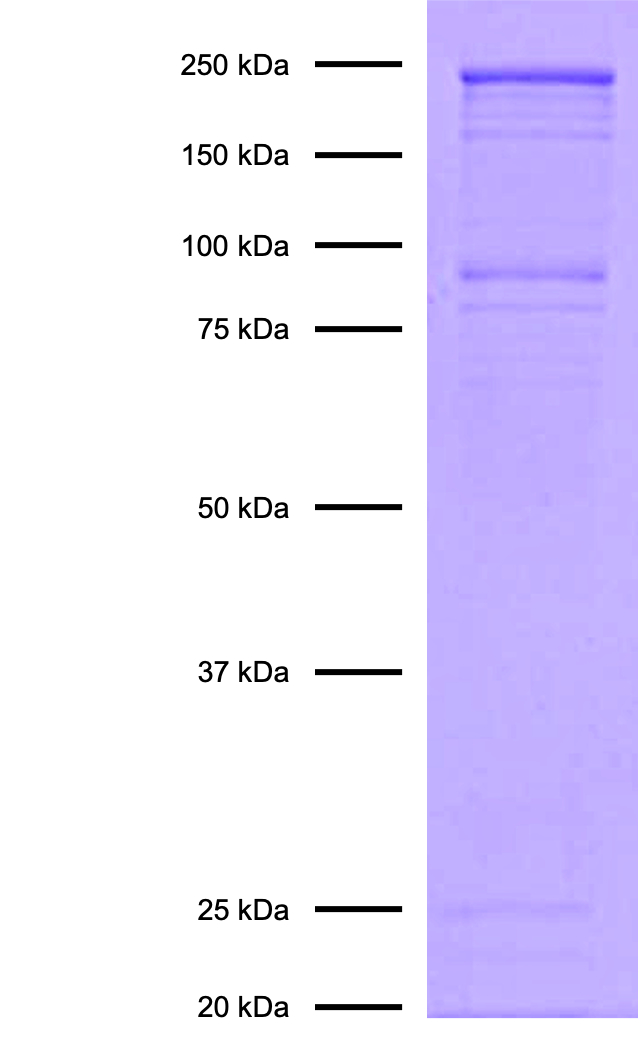 15-1015-protein-gel-data