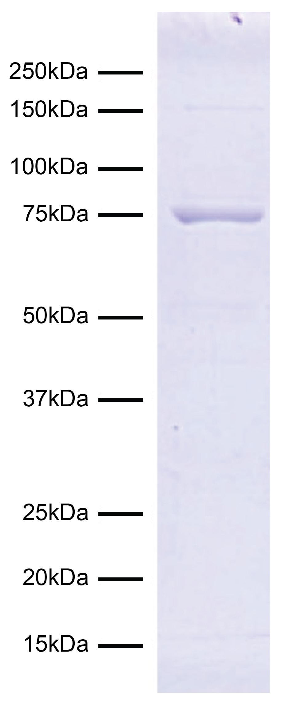 15-1017-protein-gel-data