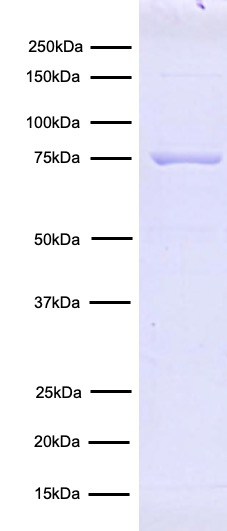 15-1026-protein-gel-data