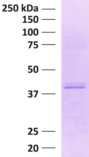 15-0009 Protein Gel Data
