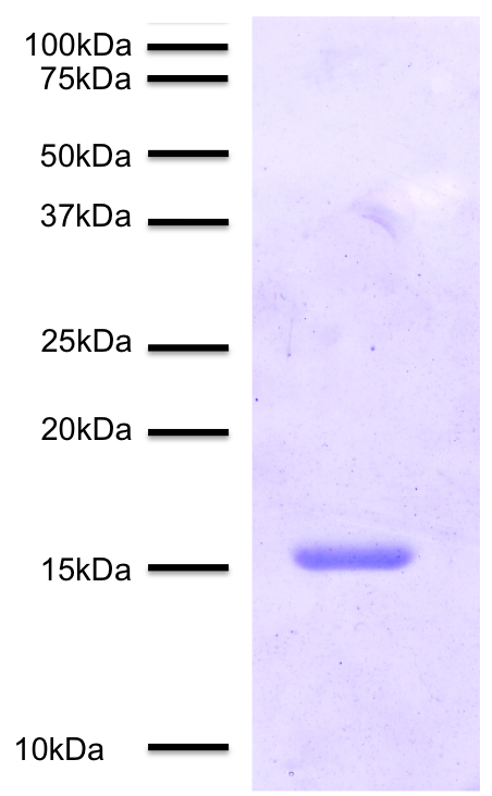 15-0047 Protein Gel Data