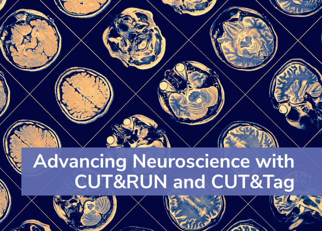 MRI scans of human brain, with title: Advancing Neuroscience with CUT&RUN and CUT&Tag