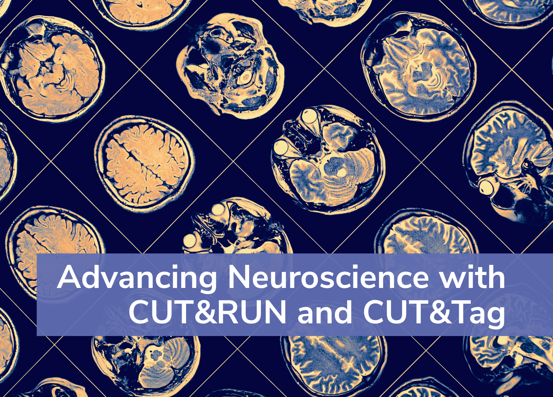 MRI scans of human brain, with title: Advancing Neuroscience with CUT&RUN and CUT&Tag