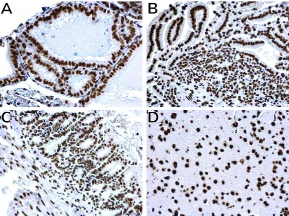 13-0050-IHC-composit