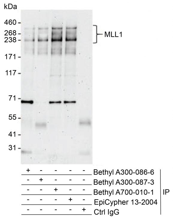 13-2004-immunoprecipitation