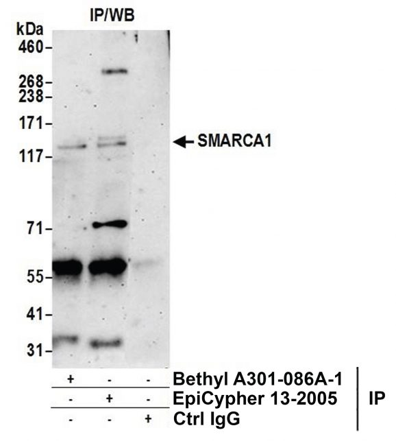 13-2005-immunoprecipitation-data