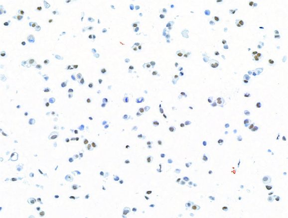 13-2014-immunocytochemistry-data