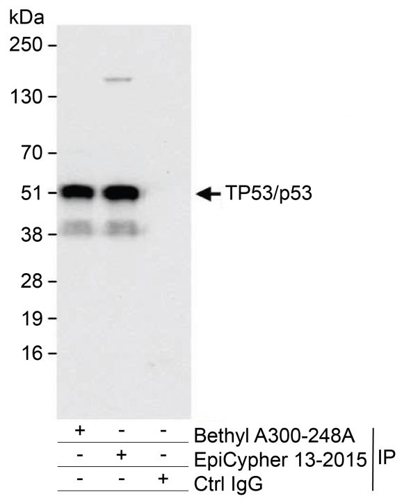 13-2015-immunoprecipitation-data