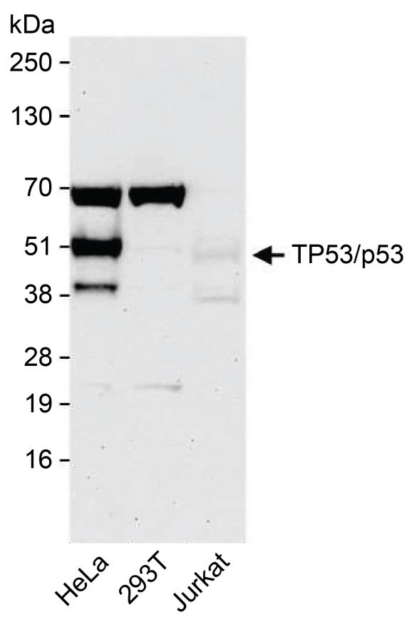 13-2015-western-blot-data