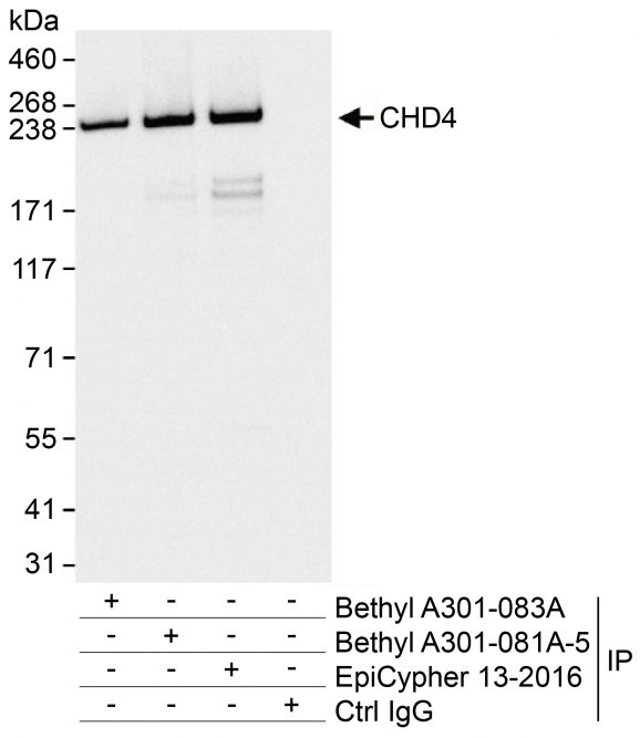 13-2016-immunoprecipitation