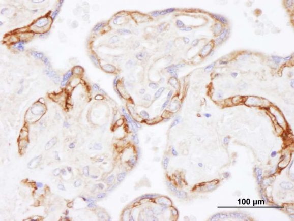 13-2018-immunohistochemistry