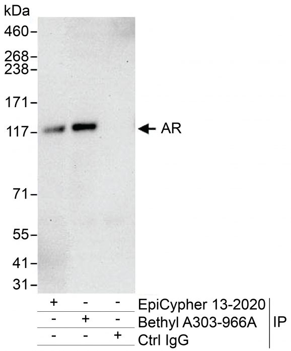 13-2020-immunoprecipitation-data