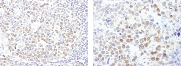 13-2026-immunohistochemistry-data