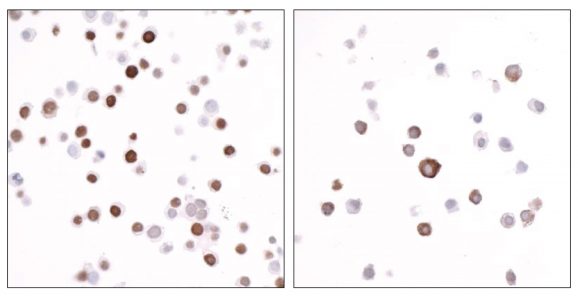 13-2031_immunocytochemistry