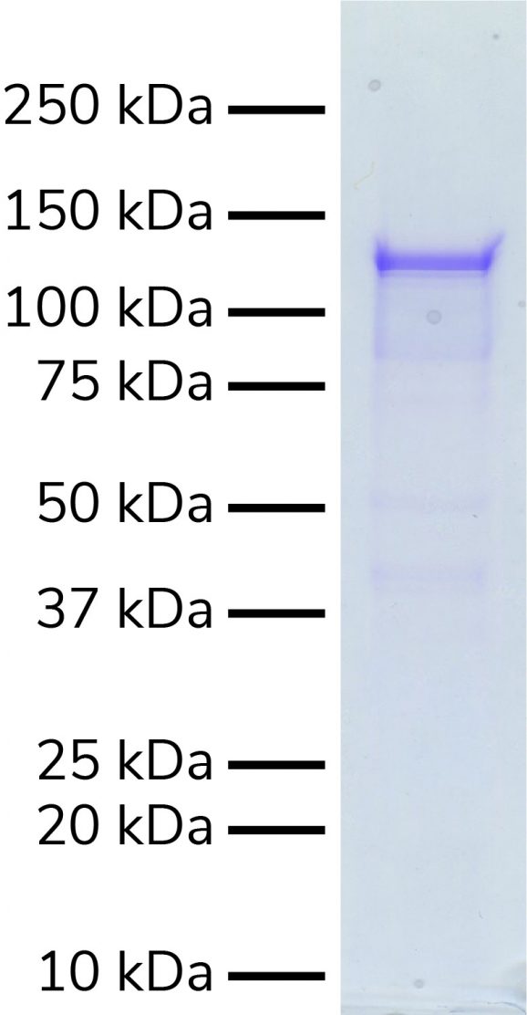 15-1024-protein-gel-data