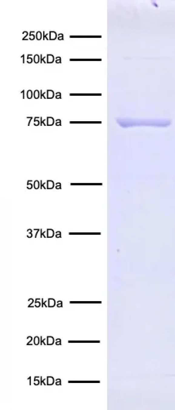 15-1026-protein-gel-data