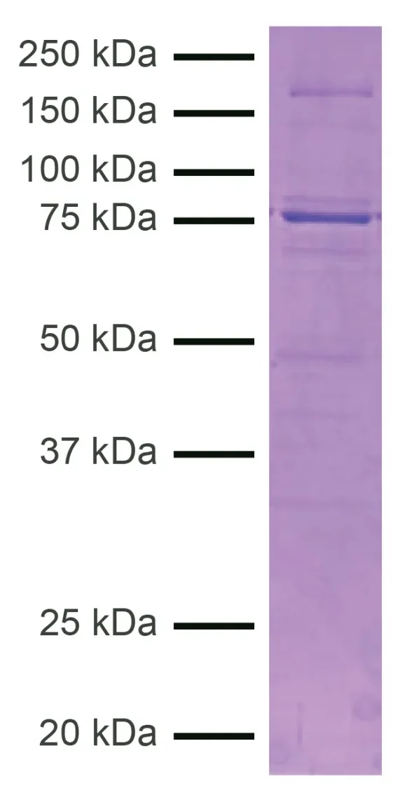 15-1028-protein-gel-data