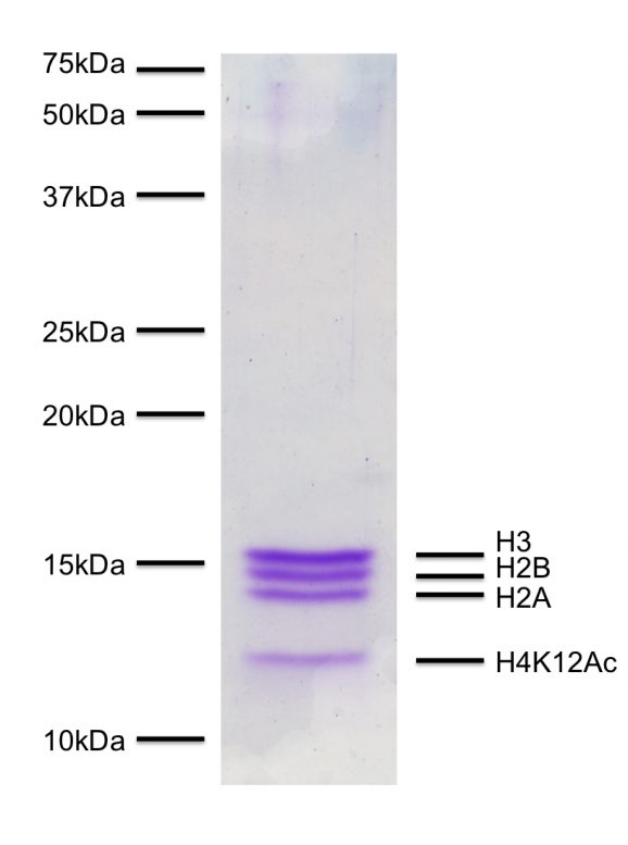 16-0312_protein_gel