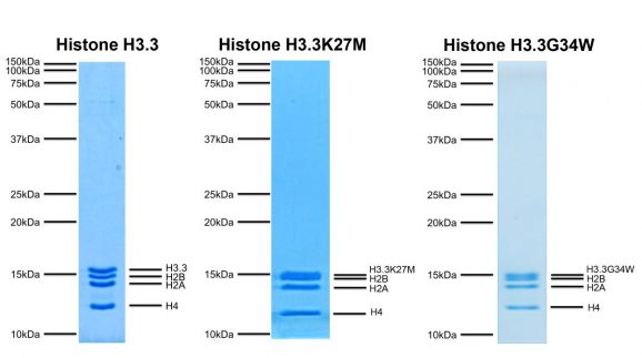 19-2001-protein-gel
