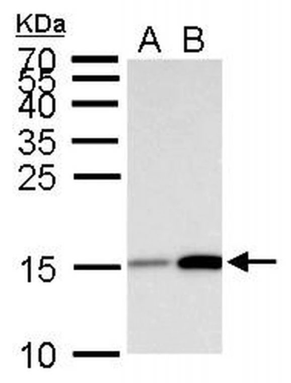 Acetyl-Histone-H3-Lys18-WB